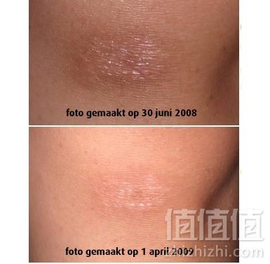 Bio-oil 百洛油 万能神油200ml（抗老化/去印/去疤/改善肤色）￥84包邮（￥99-15）