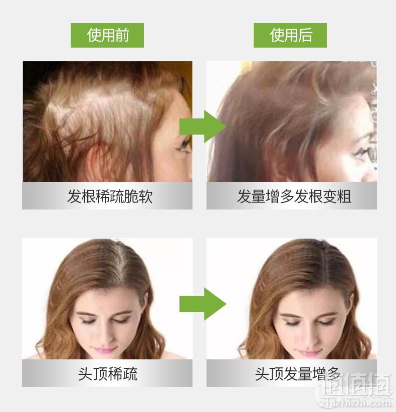 <span>白菜！</span>孕妇可用，Plantur 朴兰图 39咖啡因防脱染发洗发水250ml新低19元包邮（需用券）