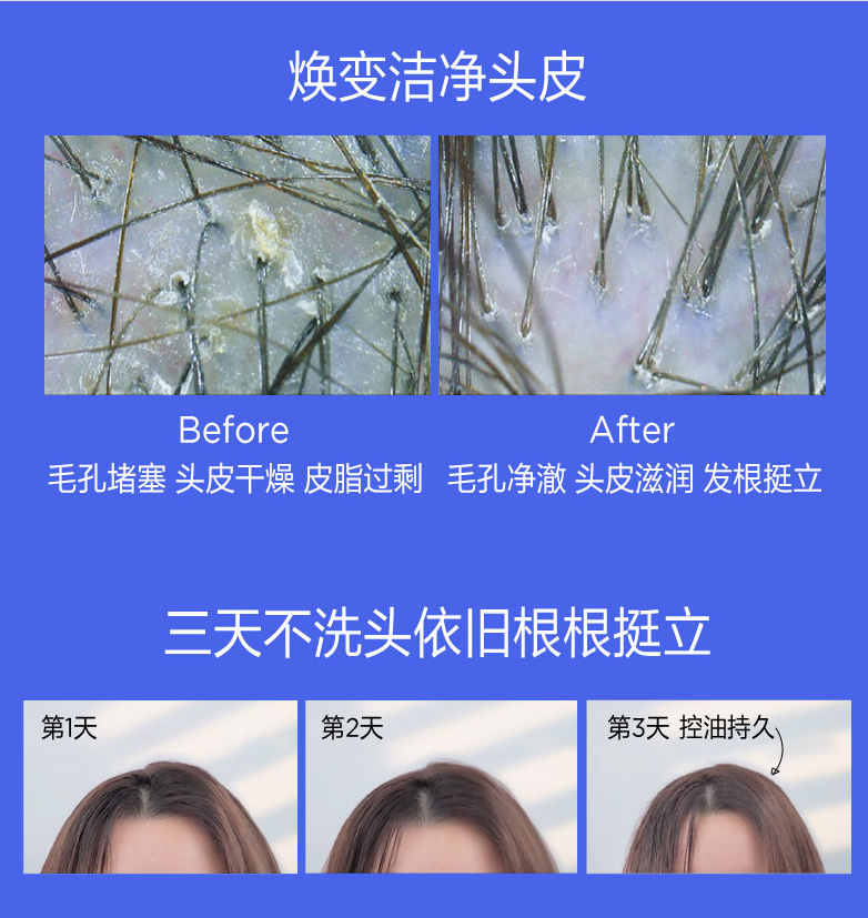 Davines 大卫尼斯 自然修护清爽控油洗发水 250ml  €11.65凑单免费直邮含税到手86元