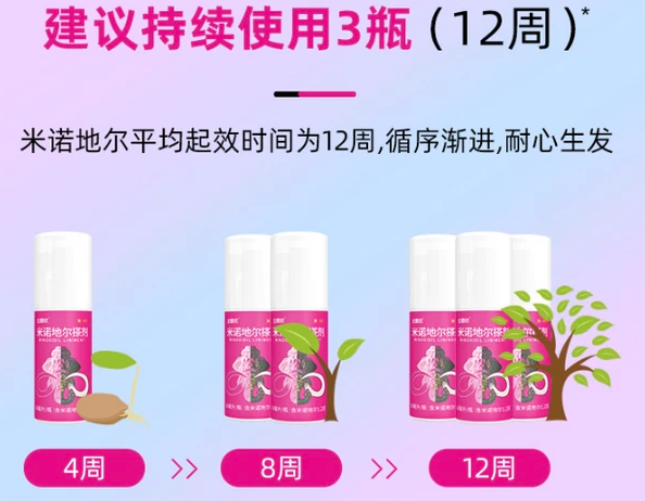 达霏欣 女用2%浓度米诺地尔搽剂 30ml49元包邮（双重优惠）