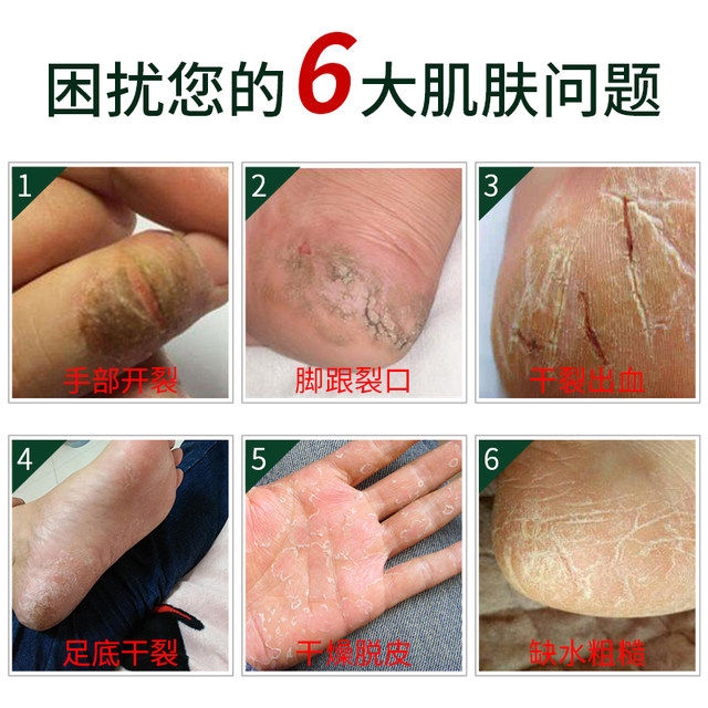 南非80年老品牌 ingrams 草本樟脑护手霜 75ml 7天见效 图3