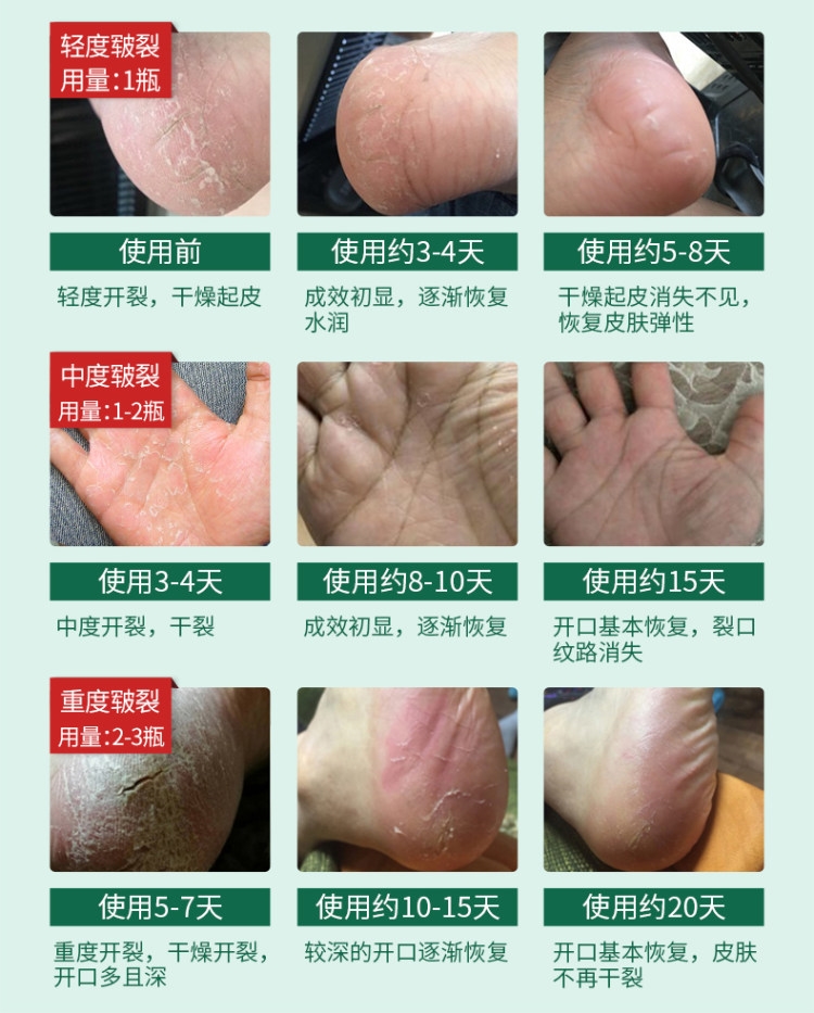 南非80年老品牌 ingrams 草本樟脑护手霜 75ml 7天见效 图4