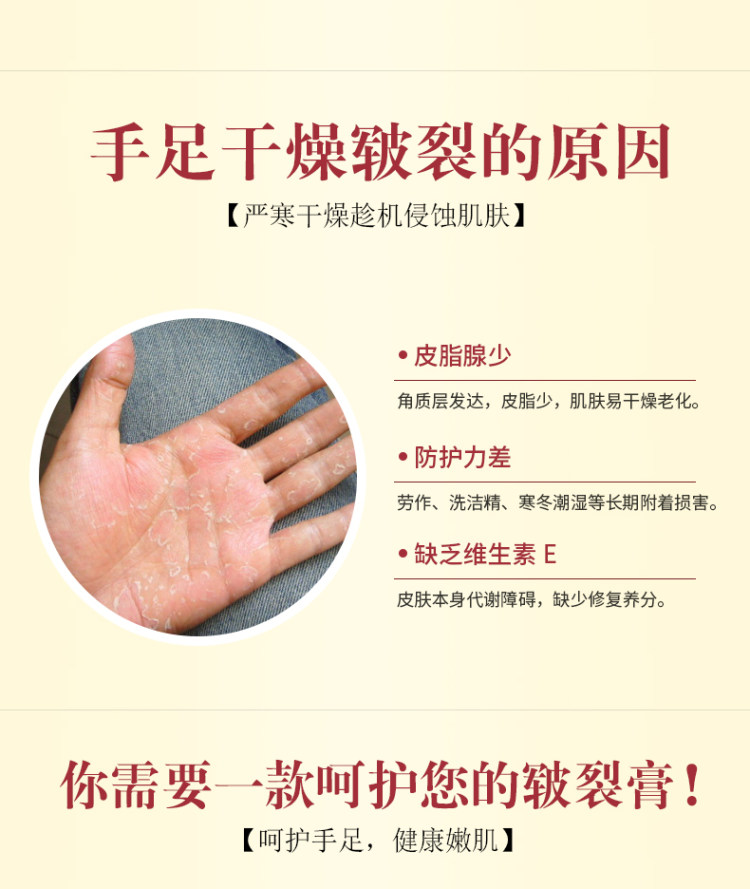 奥丽  马油手足皲裂修复膏 图3