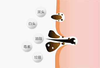 李佳琪推荐 雪玲妃 芝士拉丝除螨皂 洁面除螨虫 100g 图6