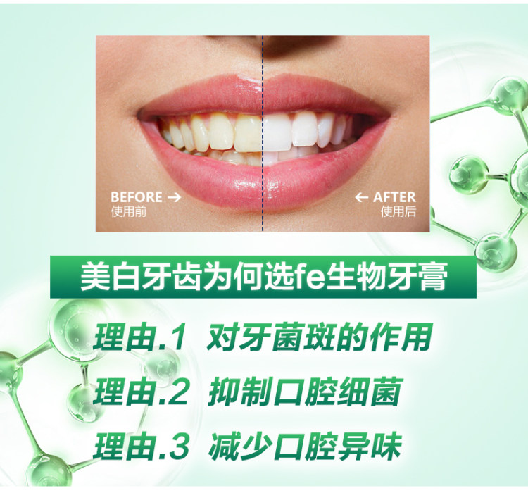 复旦大学研制 fe金典 上市纪念版 生物牙膏 4只套装 共420g 图2