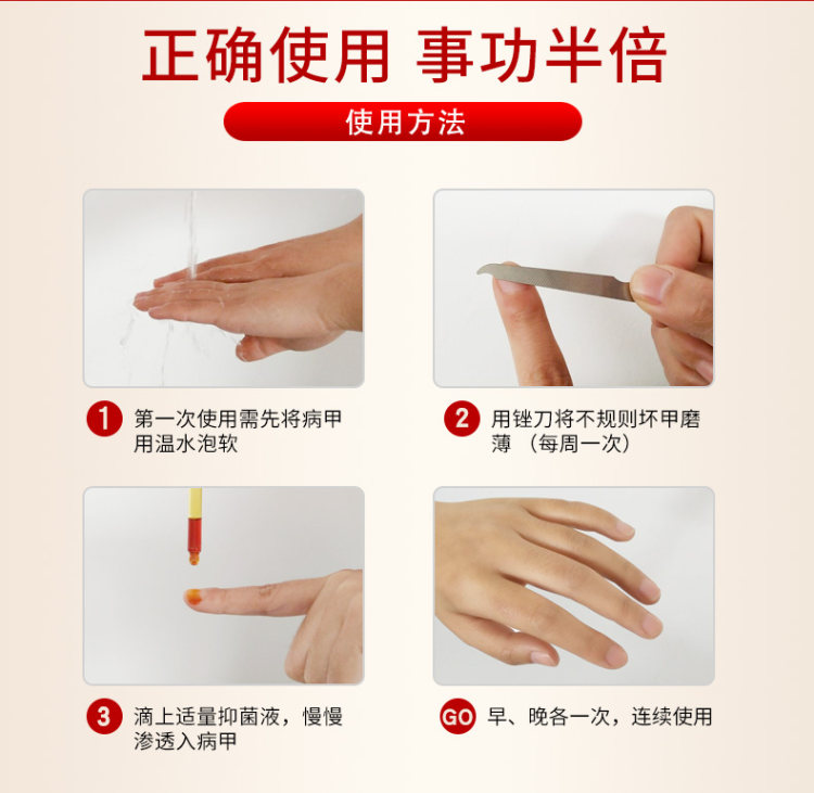 修正 去灰指甲抑菌液  去除增厚灰甲 图6
