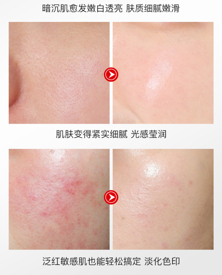烟酰胺提亮肤色原液 图7