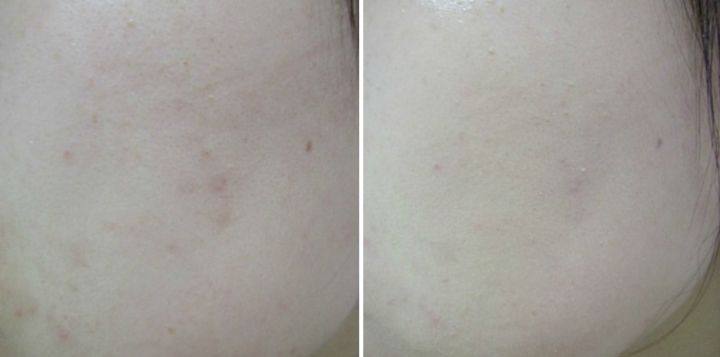 全球年销量300万 黛玛蔻 Dermacol 招牌爆款遮瑕膏 30g 纹身疤痕都能遮 图7