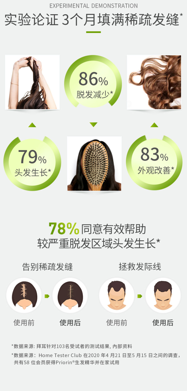 德国拜耳旗下 Priorin 生发精华液 50ml 拯救稀疏发缝 图3
