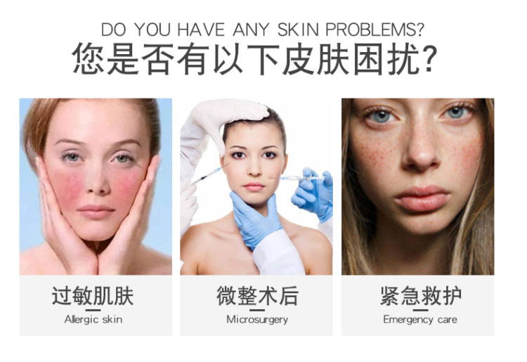 医用无菌冷敷面膜 2件共10片 图4