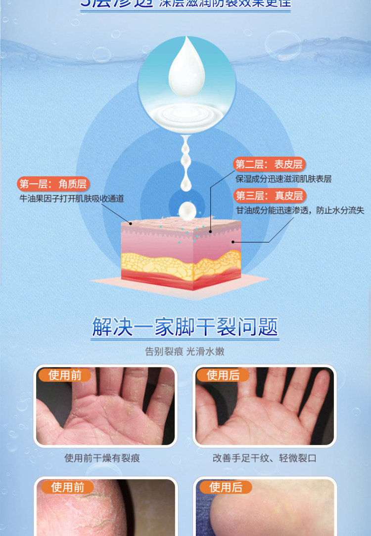 军医生 防干裂脚裂膏护手足霜 50g*2瓶 图3