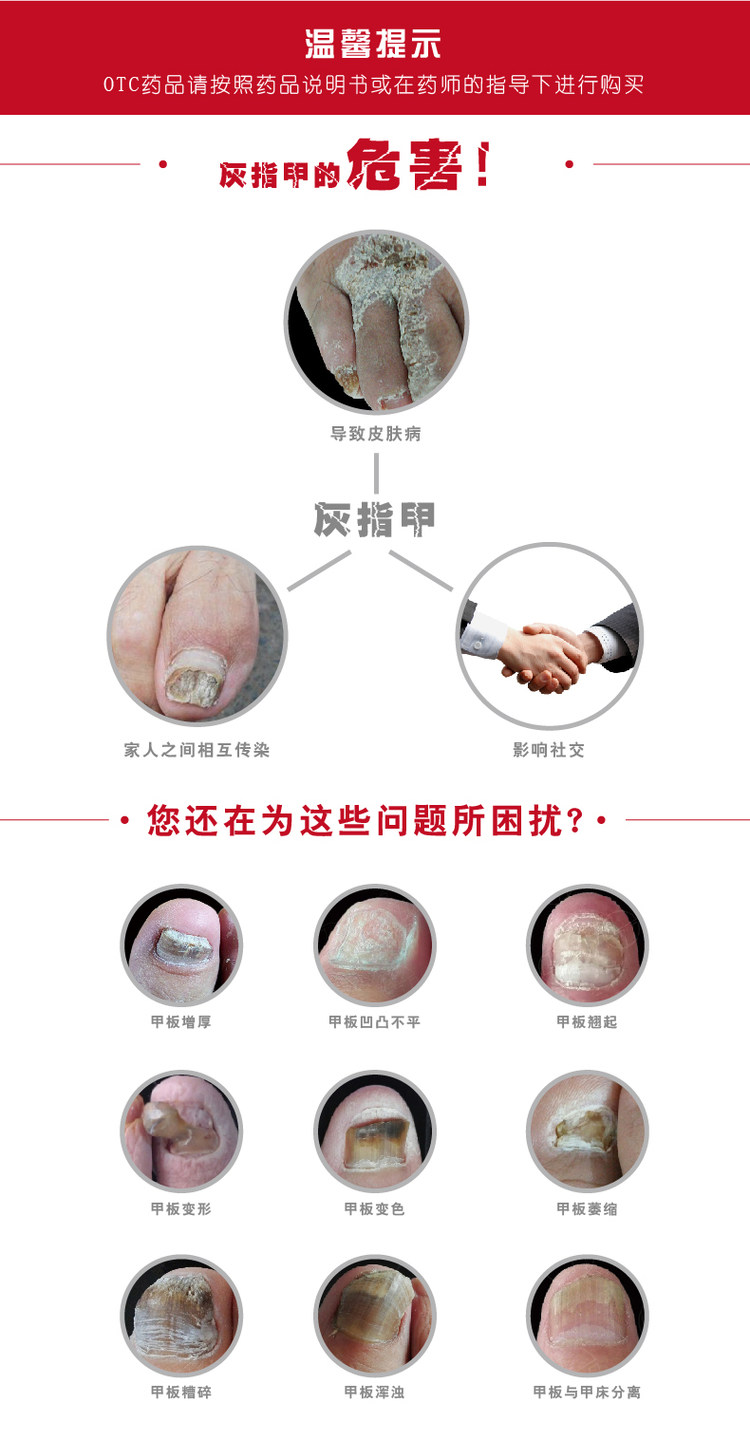 灰指甲专用 亮甲 复方聚维酮碘搽剂 3ml*2瓶 图1