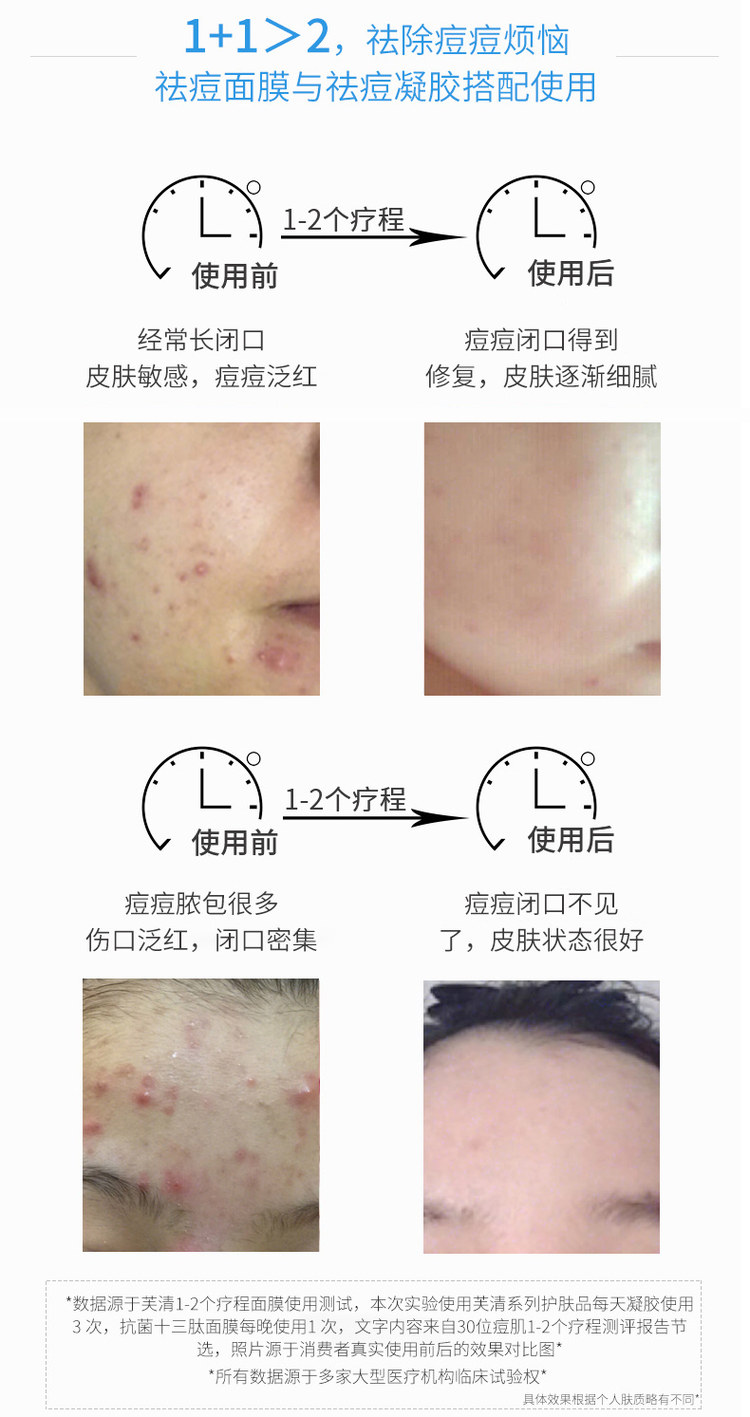 芙清 医美医用抗菌祛痘凝胶 2盒 图5