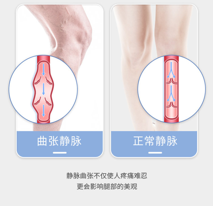 袋鼠医生 静脉曲张弹力袜1双 图8
