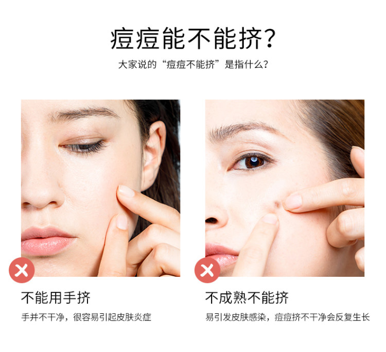 脸部美容专业黑头粉刺针套装 图3
