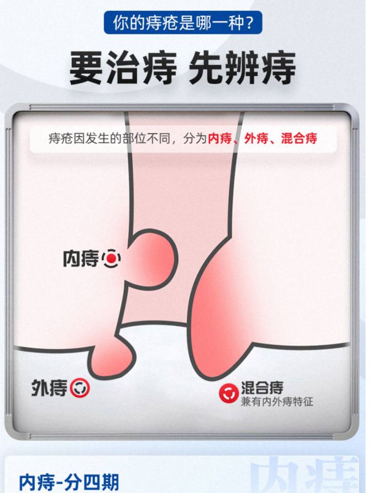 荣昌肛泰 痔疮贴肚脐贴 一盒4贴 图5