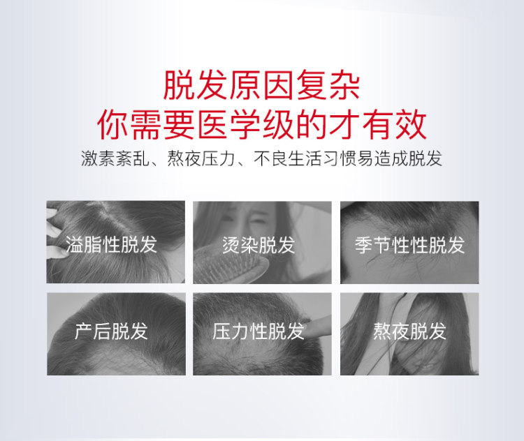 波兰进口 丝柏汀 雄性脂溢性掉发控油无硅油洗发水 2瓶 图5
