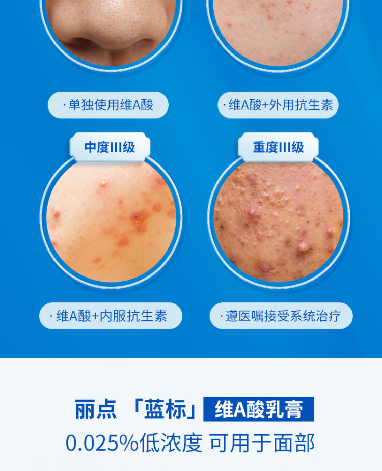 丽点 维A酸乳膏去黑头粉刺闭口 图5