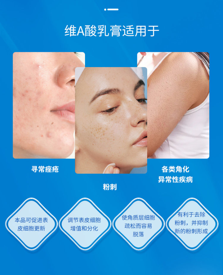 丽点 维A酸乳膏去黑头粉刺闭口 图8