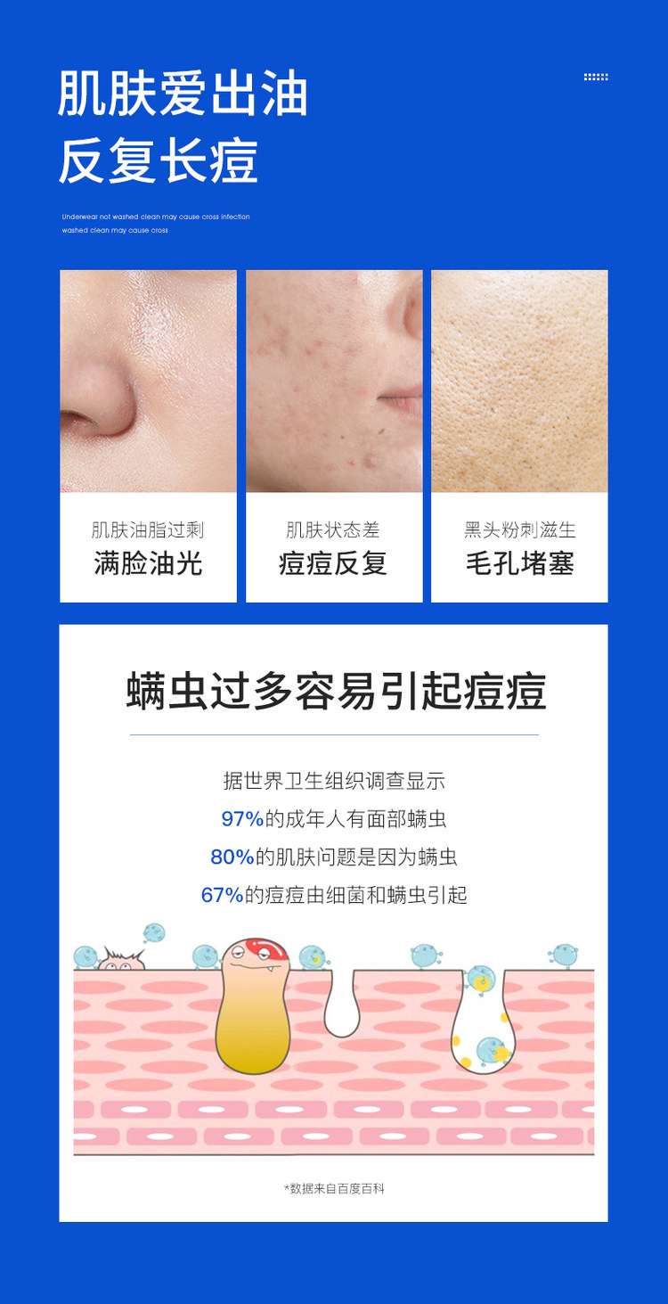 满婷 清螨皂2盒 送起泡网 图2