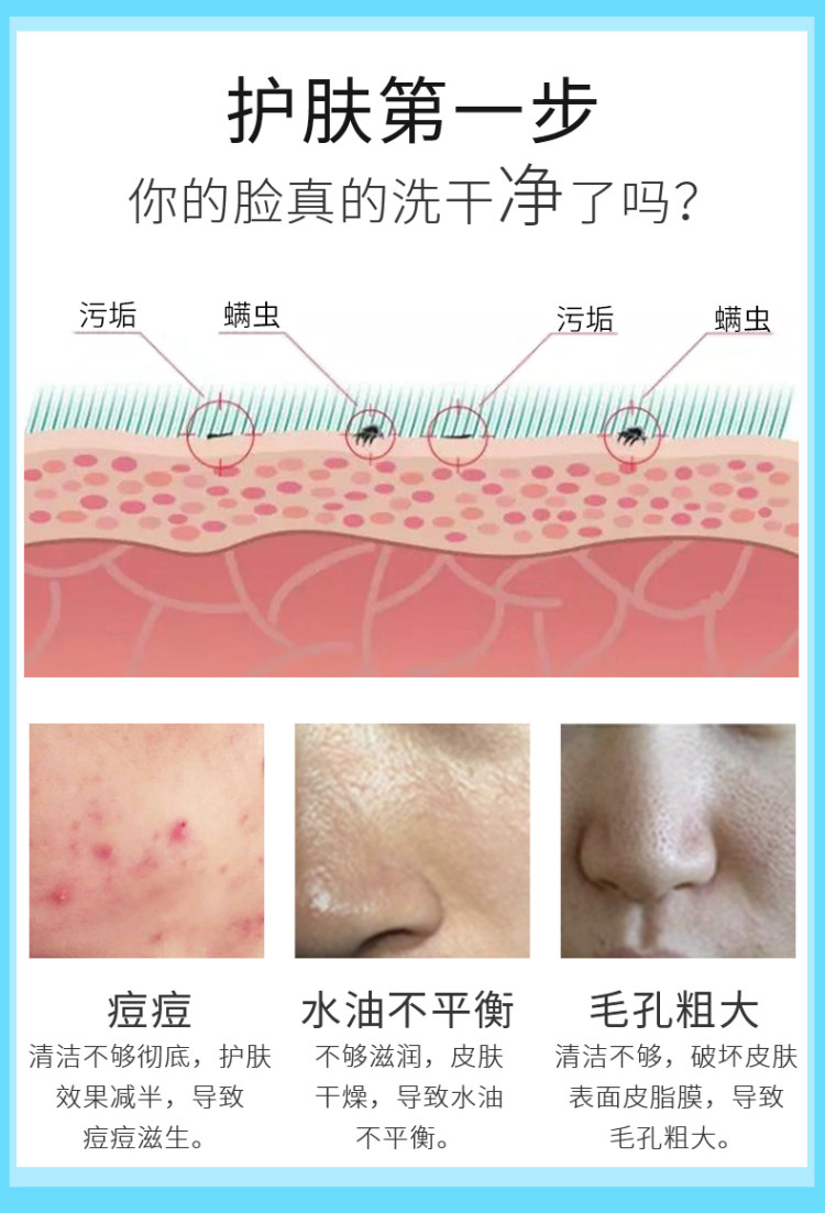 第二件0元 FQ芙清 医用氨基酸祛痘洗面奶 图3