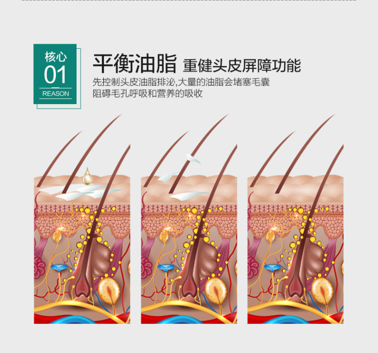章光101 防脱发育发洗发水 图6