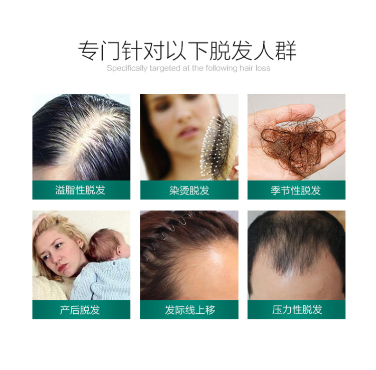 章光101 防脱发育发洗发水 图3