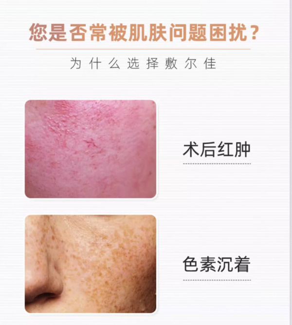 敷尔佳 医用透明质酸钠修复贴 黑膜 单盒