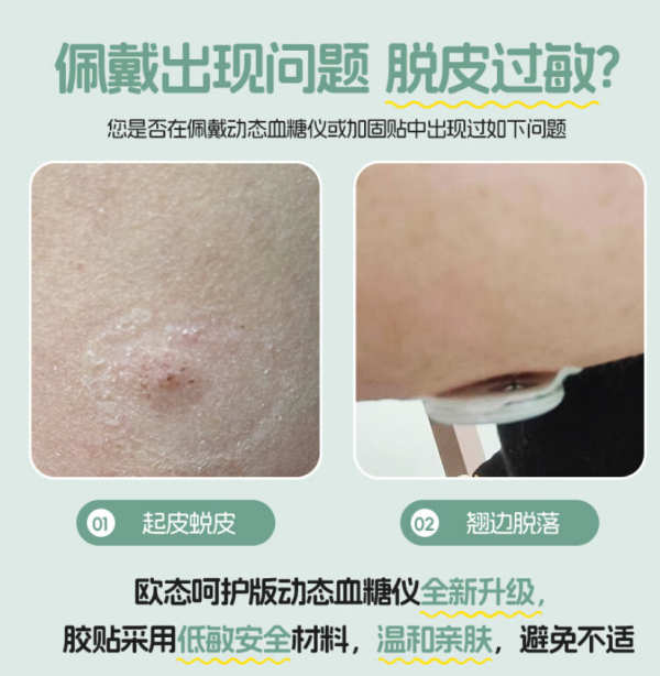 欧态 动态血糖仪免采血测糖 M8呵护版(送2片加固贴)
