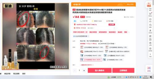 蔓迪生发喷雾米诺地尔酊90ml瓶5%浓度优惠证明