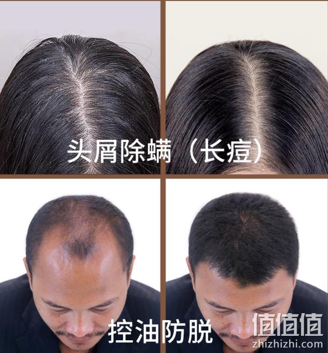 控油防脱 去屑止痒:广药白云山 生姜洗发水 400ml 双重优惠后9.9元包邮(京东69.9元) 值值值-买手聚集的地方