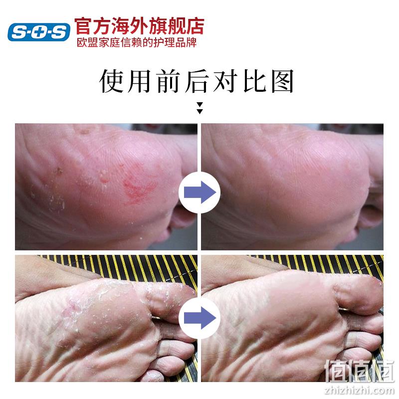 杀菌除臭 远离脚气：德国 SOS 足部杀菌除臭喷雾100ml 券后39元包邮 值值值-买手聚集的地方