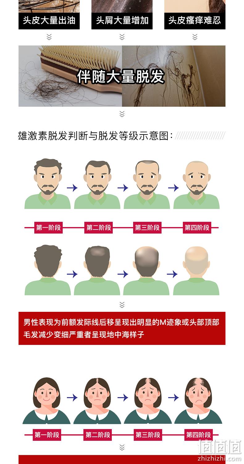 防脱发生发增发，达霏欣 5%米诺地尔酊搽剂 30ml 券后24元包邮 值值值-买手聚集的地方