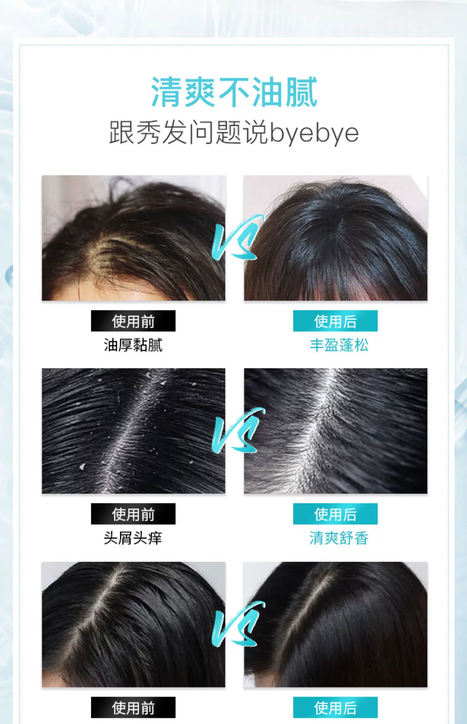 霸王 海盐头皮磨砂膏 300g*3件 34.9元包邮（11.63元/件） 值值值-买手聚集的地方