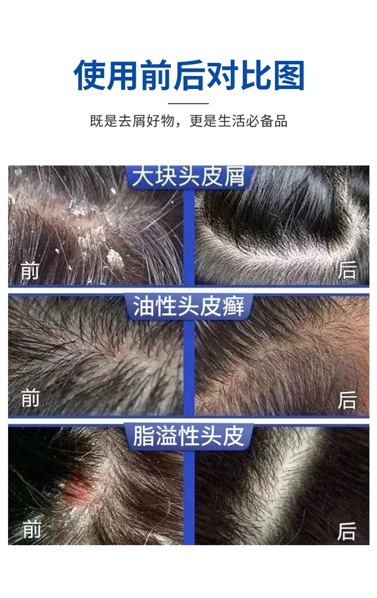 迪赛诺 希尔生 二硫化硒洗发露 100g 19元包邮 值值值-买手聚集的地方