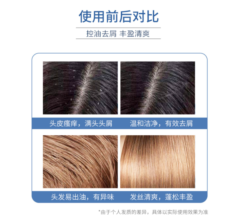 Nizoral 仁山利舒 止痒去屑防脱洗发水 50ML 19元包邮 值值值-买手聚集的地方
