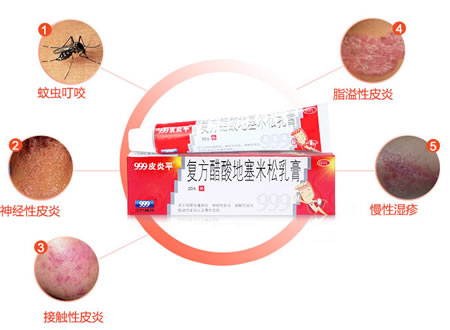 999皮炎平乳膏