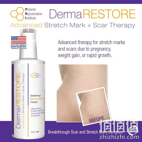 DermaRESTORE 妊辰纹疤痕修复乳霜