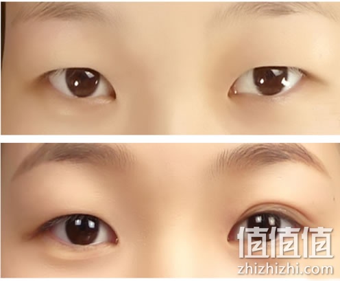 双眼贴