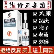 修正 鸡尤清抑菌液 去除硬茧 10ml*2瓶 拒绝反复