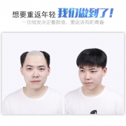 男士补发片假发套 49元（需用券）