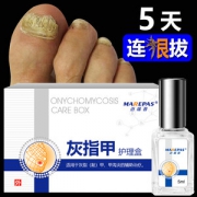 迈瑞普 灰指甲专用液