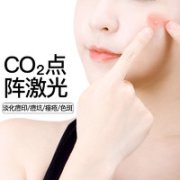 MY LIKE 美莱 CO2 激光点阵【单次】