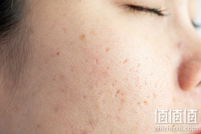美白面膜怎么选？美白面膜选购指南