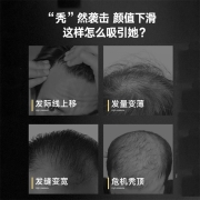 同仁堂南京生姜洗发水防脱育发洗发水秃顶脱发根控油霸王老姜王姜汁丰盈固发养发露洗发水520ml大容量