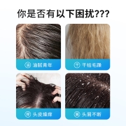 采乐 洗发水去屑止痒洗发露750ml男女士适用（清爽控油 温和氨基酸 柔顺滋润）