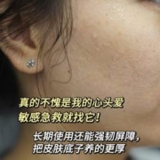 年货先到家：FORCOLAGEN 肤可新 重组人源化胶原蛋白医用敷料 4盒装