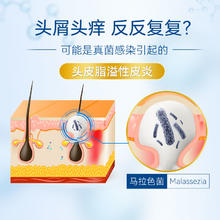 KANGWANG 康王 酮康唑洗剂洗液康王洗发水脂溢性皮炎去屑止痒头皮屑酮康挫非复方