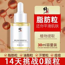 百亿补贴：修正 颗粒清肌净颜精华液眼部护理祛脂肪粒祛痘平衡油脂净化维稳