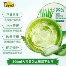 88VIP会员：Tondio 同调 芦荟胶祛痘印淡化膏300ml
